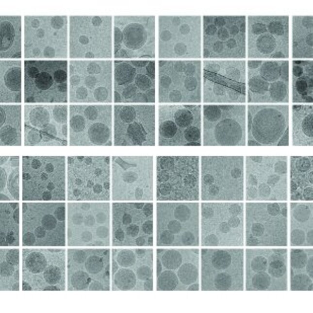 Nanoparticles under the electron microscope, crucial for Van der Meel's nanomedicine research. Photo: Roy van der Meel.